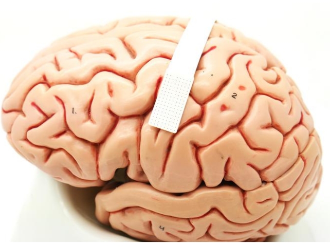 device on brain model