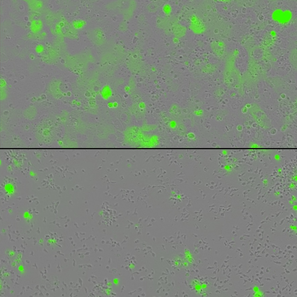 Top image shows an abundance of tumor cells in green. Bottom image shows far fewer tumor cells in green.