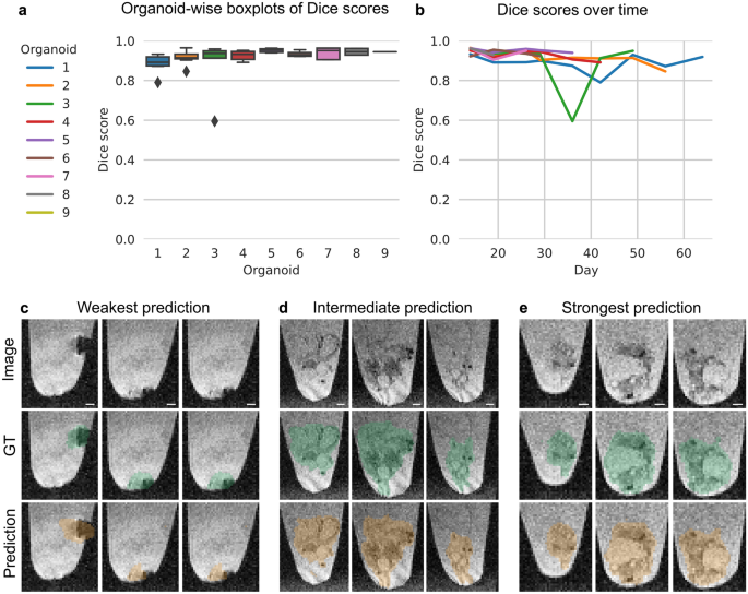 An AI-based segmentation and analysis pipeline for high-field MR monitoring of cerebral organoids - Scientific Reports