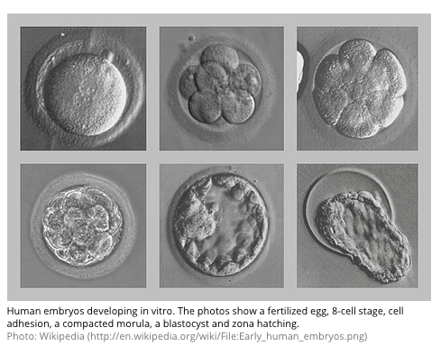 Early-human-embryos