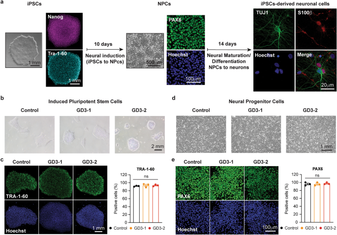 An increase in ER stress and unfolded protein response in iPSCs-derived neuronal cells from neuronopathic Gaucher disease patients - Scientific Reports