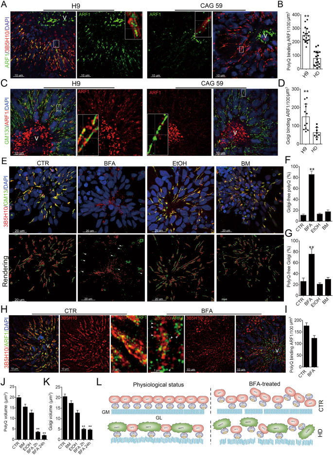 Endogenous mutant Huntingtin alters the corticogenesis via lowering Golgi recruiting ARF1 in cortical organoid - Molecular Psychiatry