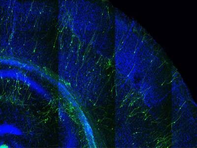 Rat neurons repair mouse brains — and restore sense of smell