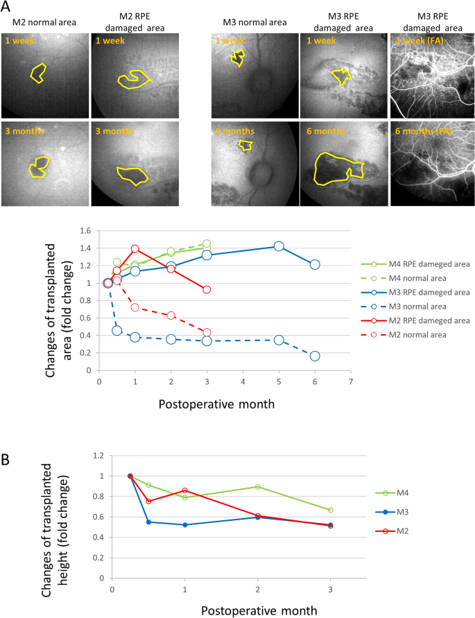 Graft cell expansion from hiPSC-RPE strip after transplantation in primate eyes with or without RPE damage - Scientific Reports