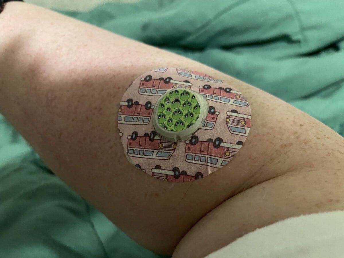 Wes Moran's decorative CGM patches