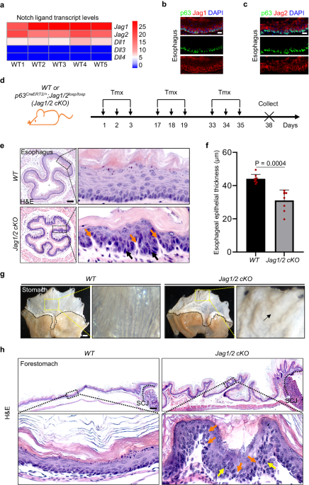 Jag1/2 maintain esophageal homeostasis and suppress foregut tumorigenesis by restricting the basal progenitor cell pool - Nature Communications