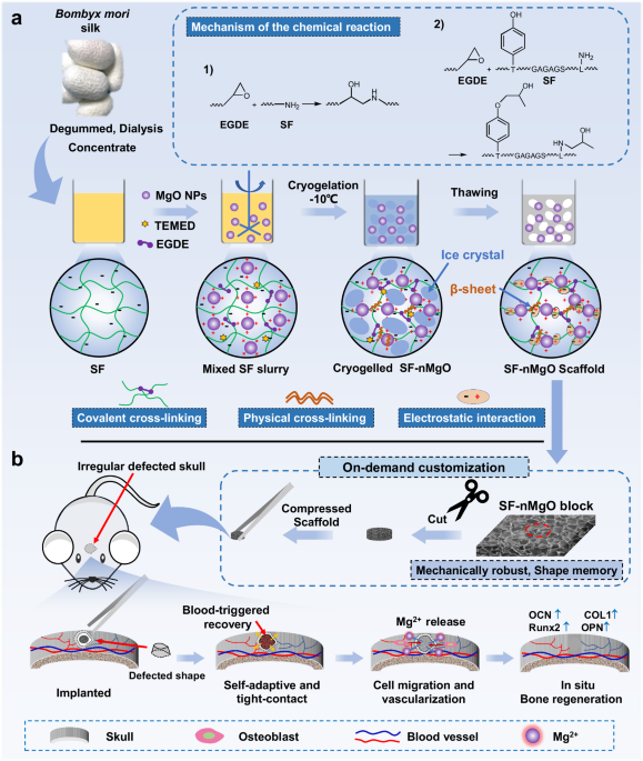 Mechanically robust and personalized silk fibroin-magnesium composite scaffolds with water-responsive shape-memory for irregular bone regeneration - Nature Communications