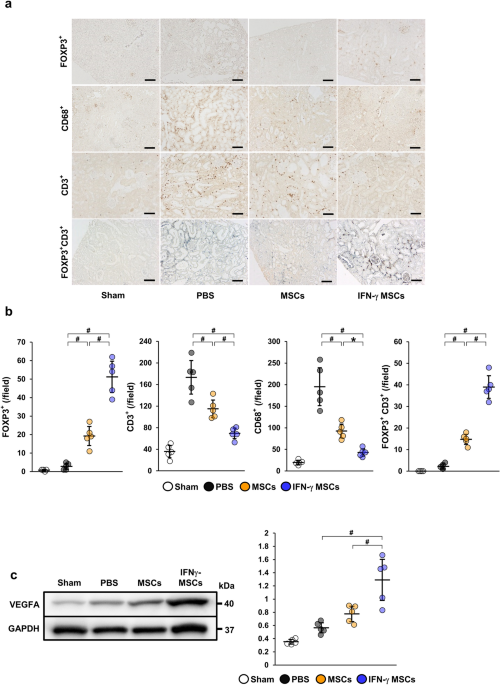 Mesenchymal stem cells pretreated with interferon-gamma attenuate renal fibrosis by enhancing regulatory T cell induction - Scientific Reports