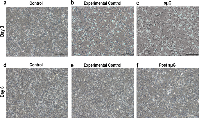 Simulated lunar microgravity transiently arrests growth and induces osteocyte-chondrocyte lineage differentiation in human Wharton’s jelly stem cells - npj Microgravity