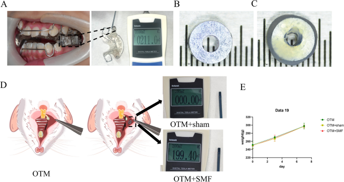 Static magnetic field-induced IL-6 secretion in periodontal ligament stem cells accelerates orthodontic tooth movement - Scientific Reports