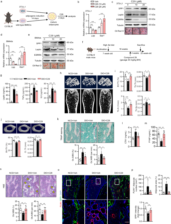 Targeting adipocyte ESRRA promotes osteogenesis and vascular formation in adipocyte-rich bone marrow - Nature Communications