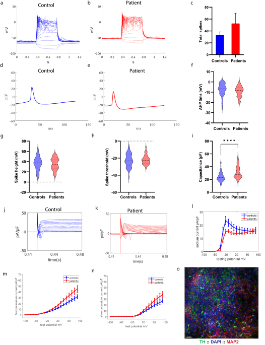 Upregulated ECM genes and increased synaptic activity in Parkinson’s human DA neurons with PINK1/ PRKN mutations - npj Parkinson's Disease