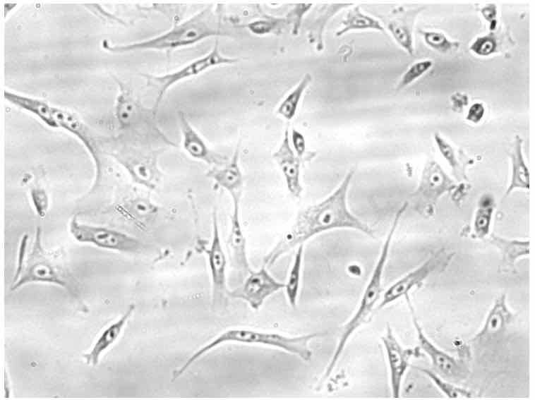 mesenchymal cells, regenerative medicine